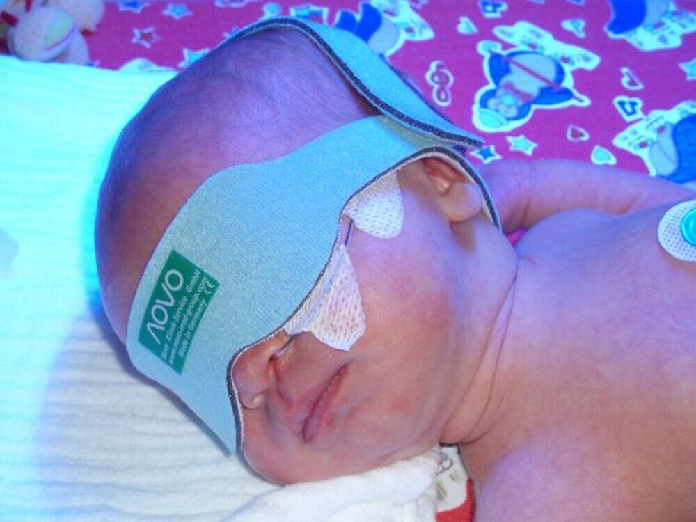 NOVO Eye Care