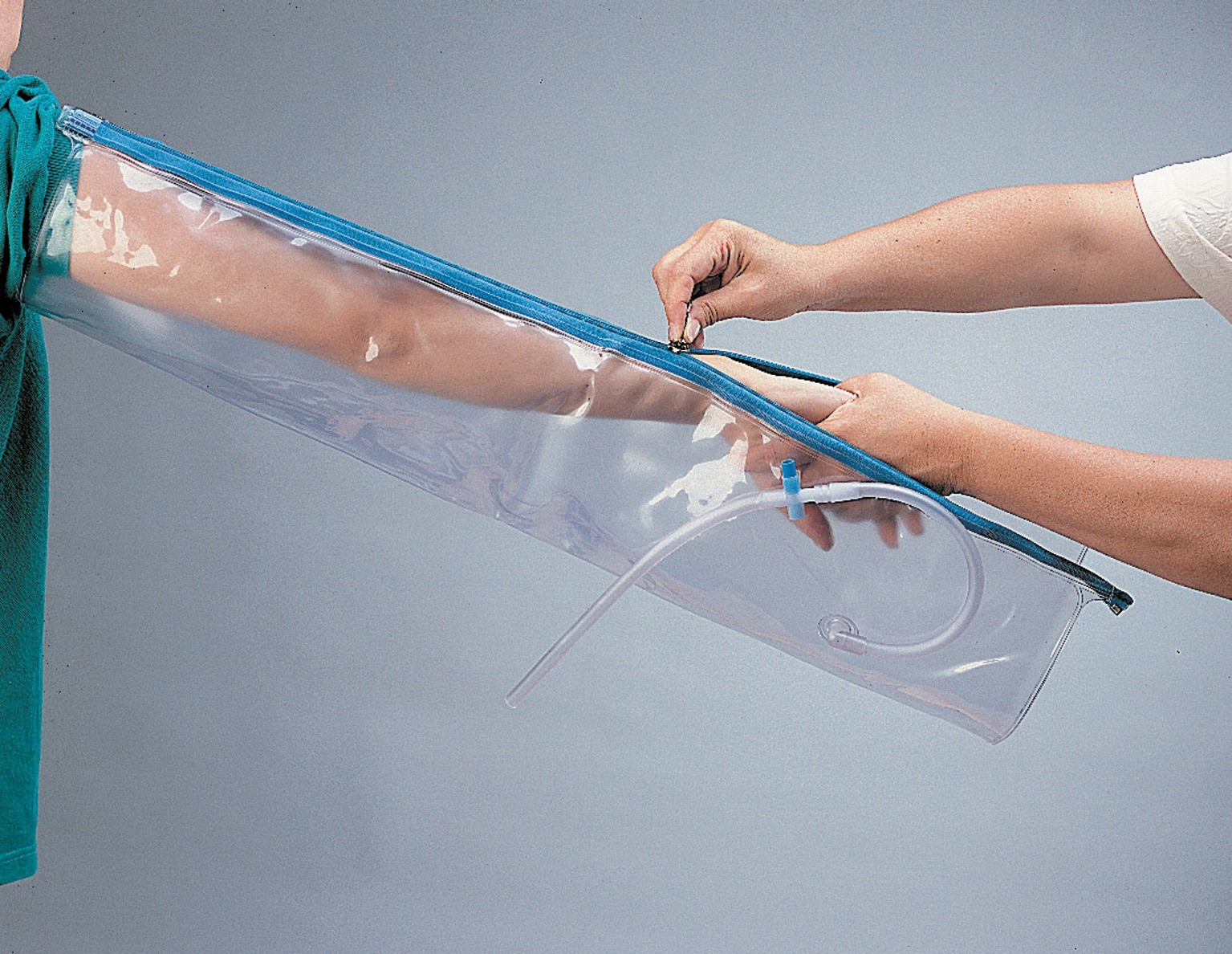 Attelle de Urias-Johnstone bariatric